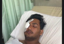CJP प्रदर्शन में घायल छात्र की आंख की रोशनी पर संकट, डॉक्टरों ने जताई सिर्फ 1% उम्मीद